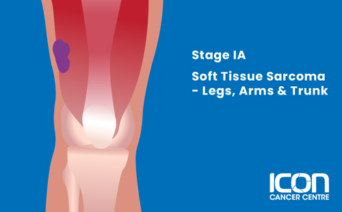 Stage IA soft tissue sarcoma in arms, legs and trunk illustration