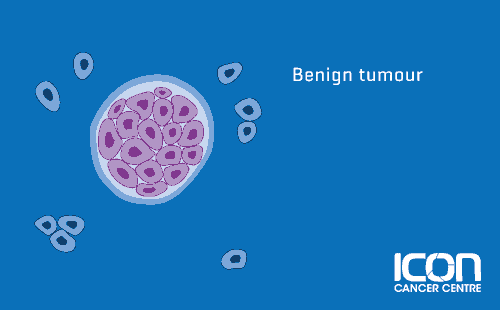 Benign-tumour_ICC-Aus.png