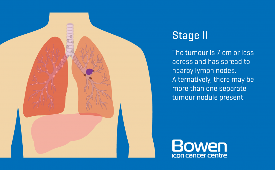 What is Lung Cancer? Lung Cancer Explained — Bowen Icon