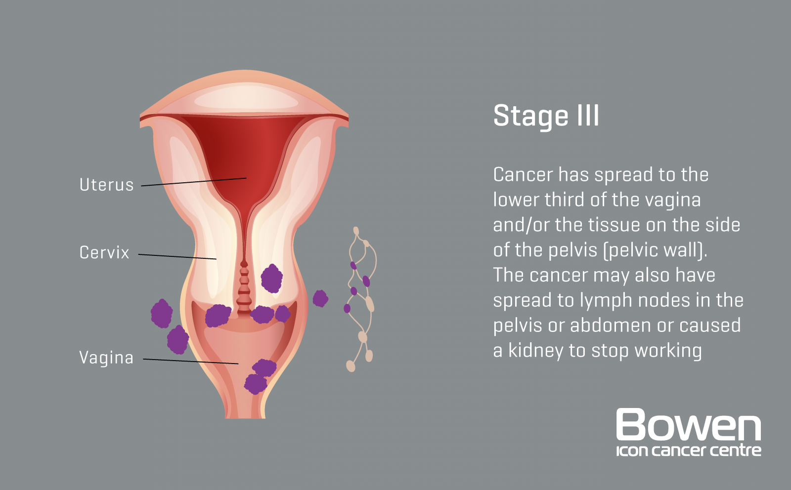 how does hpv cause cervical cancer mechanism